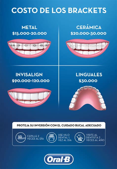 brackets zafiro y metalicos|cuanto cuesta ponerse brackets.